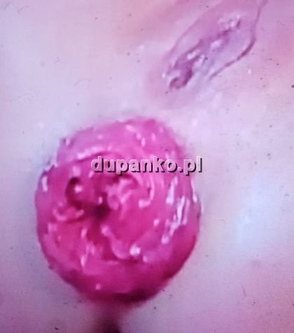 Fisting cipki fisting analny, Poznań, wielkopolskie - sex anons zdjęcie nr 1